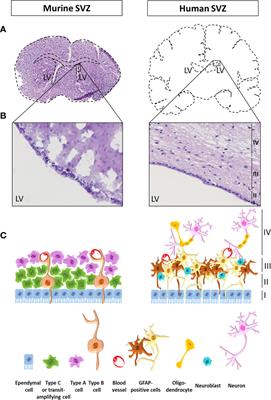 The Subventricular Zone, a Hideout for Adult and Pediatric High-Grade Glioma Stem Cells